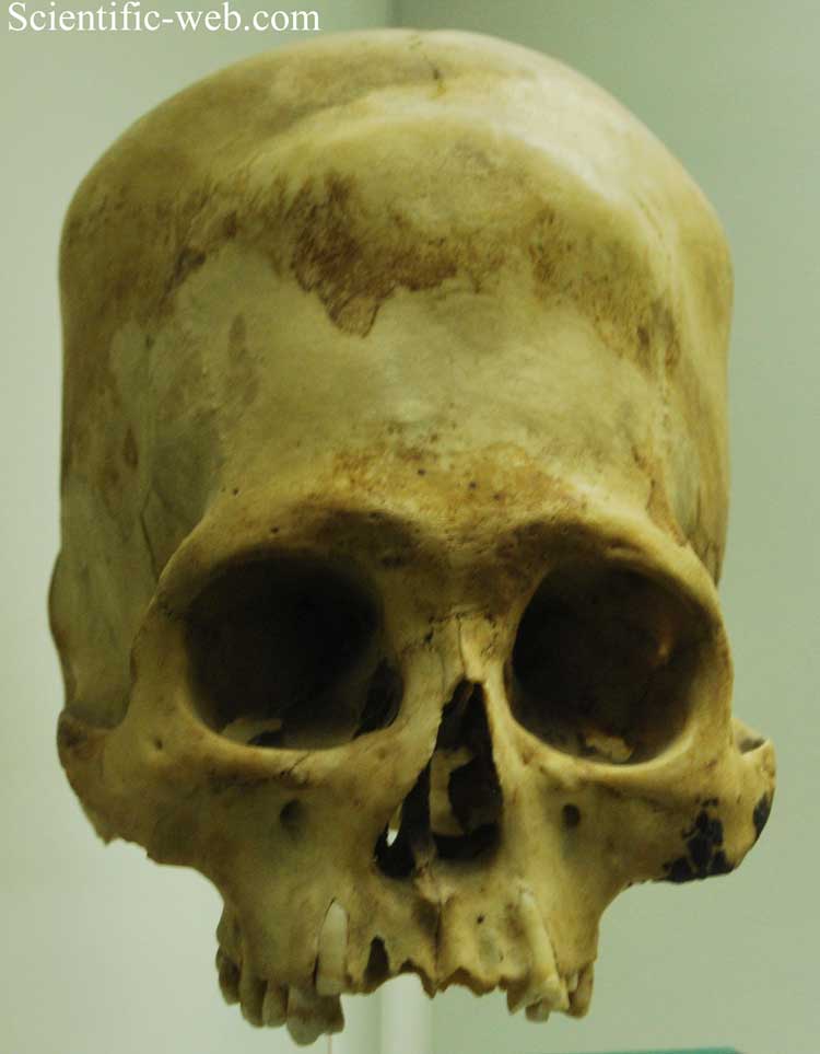 Elongated Skull, Peru