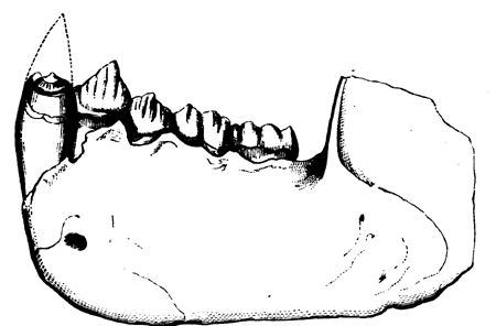 Lower Jaw of Dryopithecus Fontani.