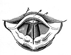 FIG. 193.—The vibration of the vocal cords produces the sound of the human voice.